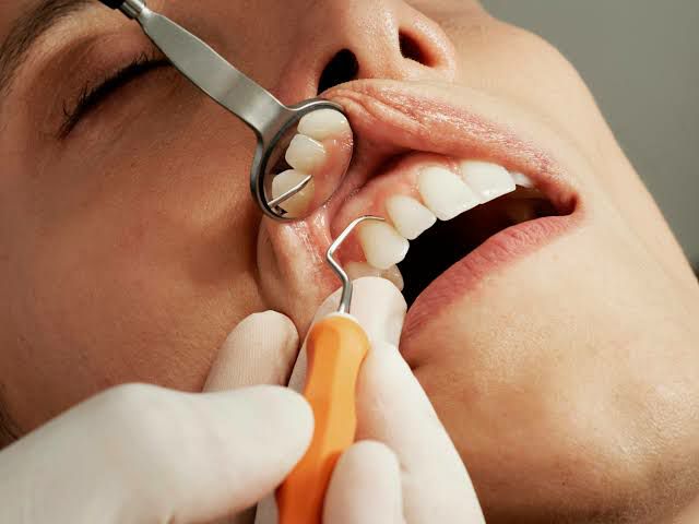 DENTAL CHECK UP AND FOLLOW UP